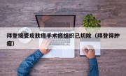 拜登接受皮肤癌手术癌组织已切除（拜登得肿瘤）