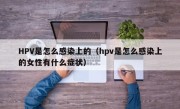 HPV是怎么感染上的（hpv是怎么感染上的女性有什么症状）