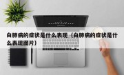 白肺病的症状是什么表现（白肺病的症状是什么表现图片）