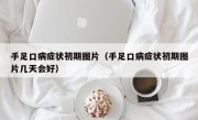 手足口病症状初期图片（手足口病症状初期图片几天会好）