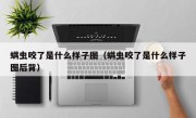 螨虫咬了是什么样子图（螨虫咬了是什么样子图后背）