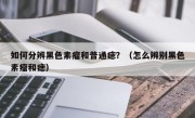 如何分辨黑色素瘤和普通痣？（怎么辨别黑色素瘤和痣）